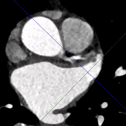 CT shot example