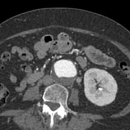 CT shot example